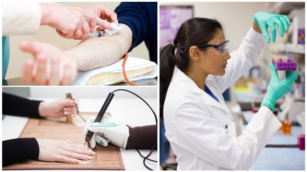 Diagnostikas metodes parazītu noteikšanai organismā