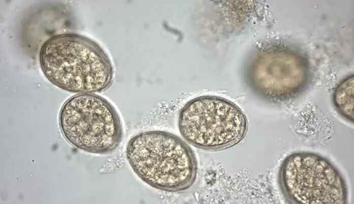 parazīti zem mikroskopa