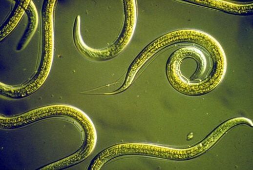 Parazītiskie nematodes tārpi cilvēka tievajās zarnās